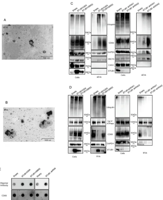 Fig 3. STUB1 inactivation stimulates the secretion of extracellular vesicles positive for sEVs markers