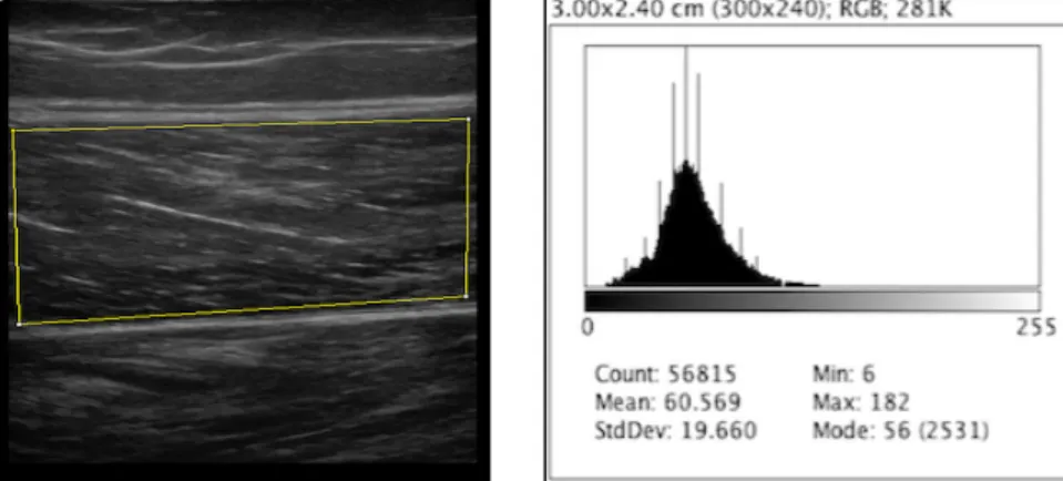 Figure  3:  Echo-intensity  measurement.  (A)  B  mode  ultrasound  of  the  vastus  lateralis  with  a  maximum  ROI  selected;  (B)  Histogram  of  the  pixel  graylevel  values  distribution  and statistics obtained using Image J software