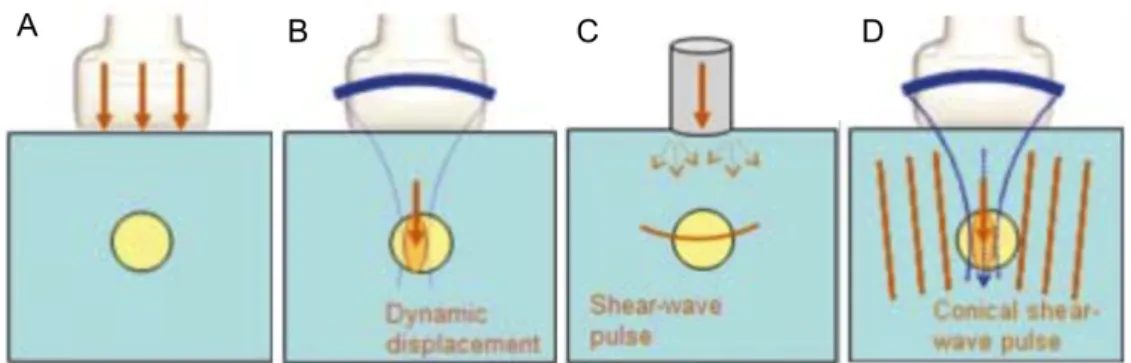 Figure  5:  Scheme  of  ultrasound  elastography  methods.  (A)  Strain  elastography;  (B)  acoustic radiation force impulse elastography; (C) transient elastography; (D) shear wave  elastography