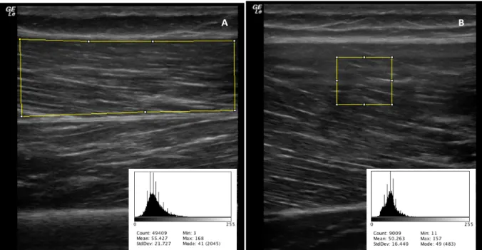 Figure  12:  Ultrasound  images  of  two  different  ROIs  used  to  measure  muscle  echo- echo-intensity