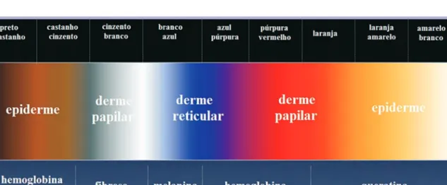 Fig 1 - A localização do cromóforo hemoglobina nas diferentes camadas da pele condiciona a sua observação dermatoscópica  com cores distintas.