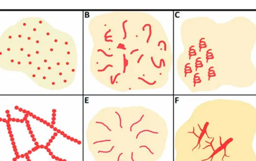 Fig 8 - Arranjo e distribuição dos vasos em dermatoscopia: (A) regular; (B) irregular; (C) arranjo em clusters; (D) arranjo em “colar  de pérolas”; (E) radial; (F) ramificado.