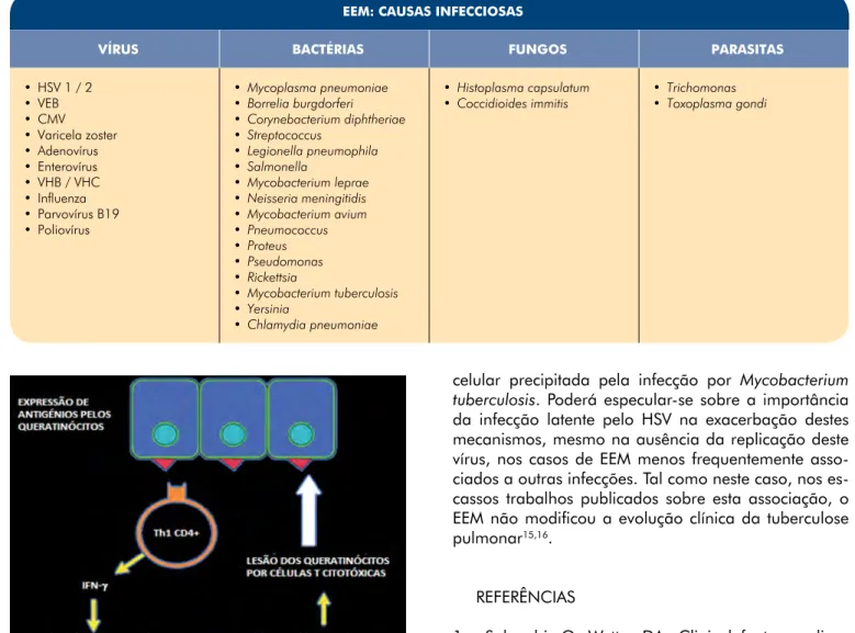 Tabela 1 -  Associação entre EEM e agentes infecciosos.
