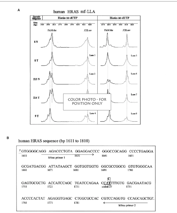 Figure 6. HRAS mutation polymorphism detection in human gastric cancer specimens. (A) Depicted is a sample result from tumor (T) and corresponding normal (N) gastric biopsies of three individuals