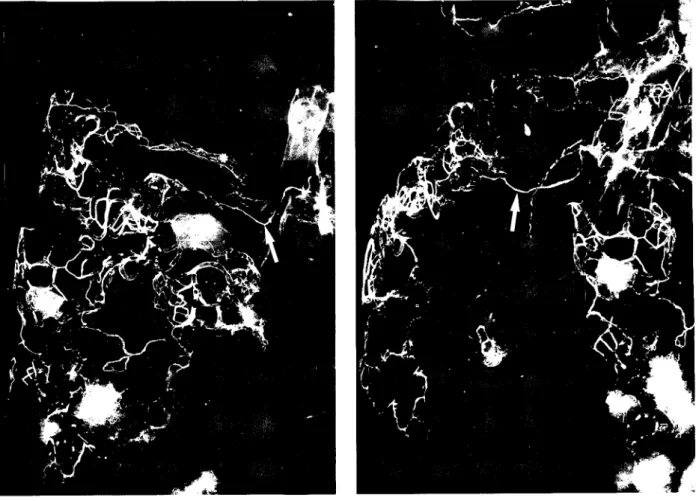 Fig. 2.2. - Imagens radiográficas da rede linfática pleural humana obtidas após injecção com  sulfato de bário