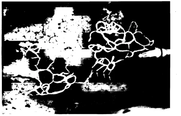 Fig. 2.3. - Após a canulação e injecção do produto destinado ao preenchimento dos  capilares linfáticos vários ramos em dedo de luva são revelados como se ilustra  nesta imagem (setas)