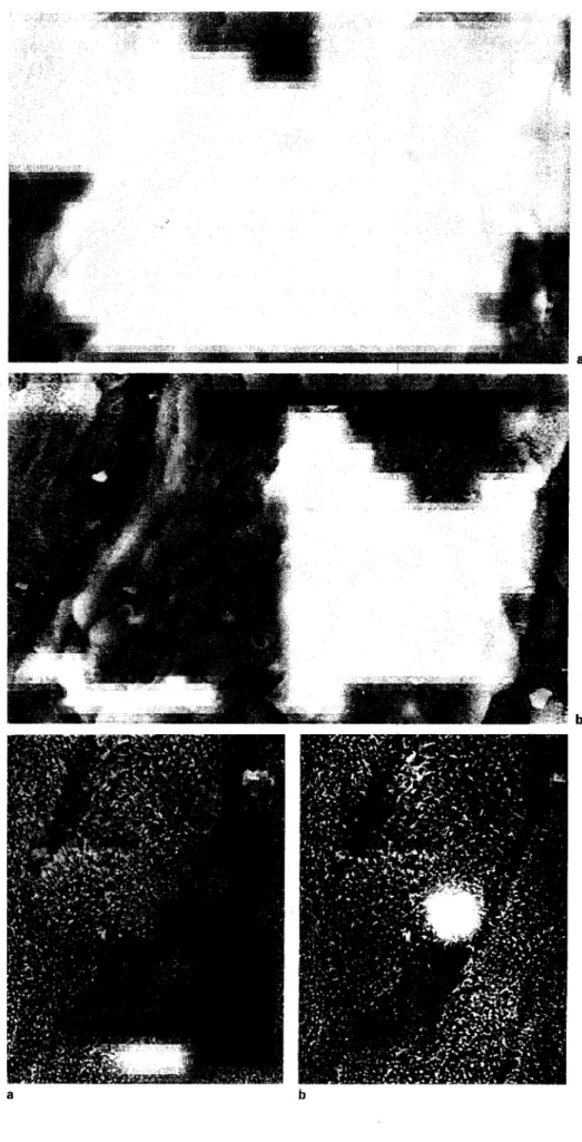 Fig. 1. a Scanning electron micrographs  of parietal pleura 3 days after instillation of  tungsten particles in the pleural space, b The  elemental analysis picks up numerous  tungs-ten-positive cells, x 26,250
