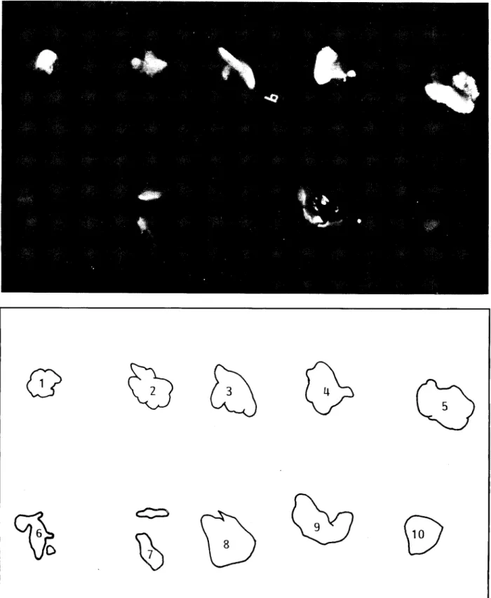 Fig. 2. X-ray of nodal samples with accompanying line drawing 3 days after instillation ofCaW0 4  into  the pleural space