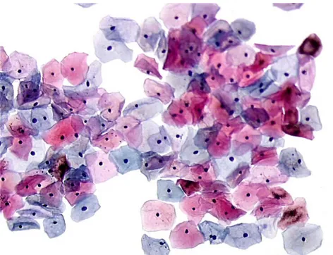 Figura  4:  Ectocérvice  normal.  Citologia  cervical  com  representação  de  células  escamosas  intermediárias  basofílicas  e  células  superficiais  com  citoplasmas  basofílico  ou  eosinofílico  (objetiva  10x)