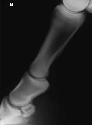 Figura  4  -  A.  Vista  LM  da  articulação  IFP  anatomia;  B.  Vista  LM  da  articulação  IFP  no  RX