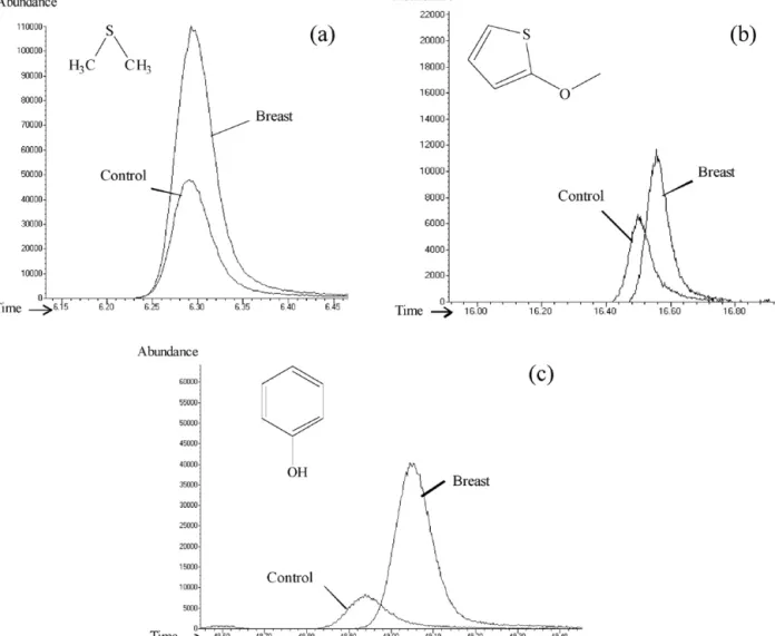 Fig. 3. Comparison between healthy and oncologic group of 3 illustrative metabolites selected from 79 compounds analyzed