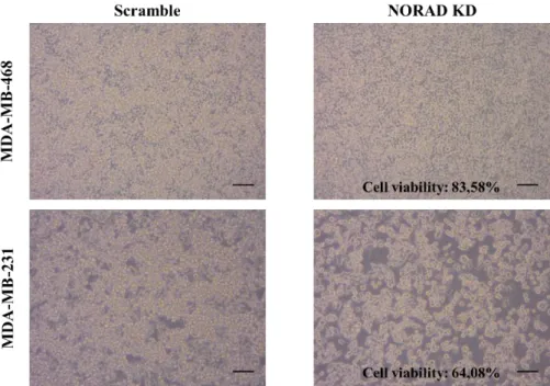 Figure 4.5: NORAD knockdown effect on cell viability. MDA-MB-468 and 231 cell lines were visualized and photographed  in a Primo Vert inverted microscope (Carl Zeiss) (10x objective) incorporated with an AxioCam ER c5s