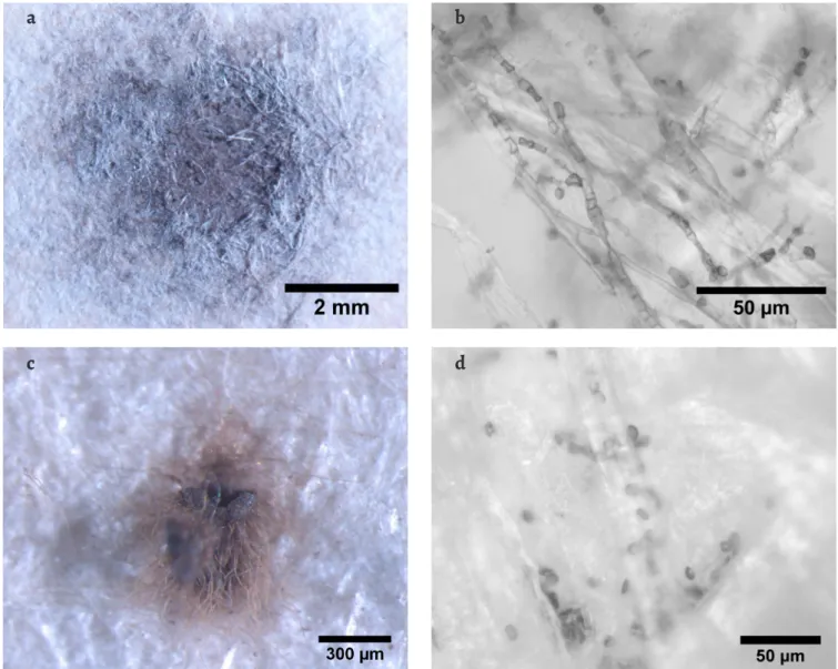 Figure 3. Stereo microscopy and OM images of stains and fungal structures observed on document D1: a) stain D1-B under the stereomicroscope; b) OM  image of microbial cells observed on sample D1-B; c) stain D1-H under the stereomicroscope; d) OM image of a
