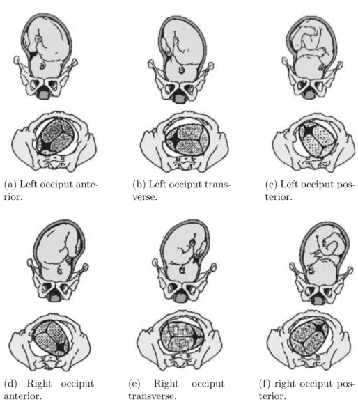 Figure 2.10: Foetal presentations and positions in labour. From ([Gabbe et al., 2007]).