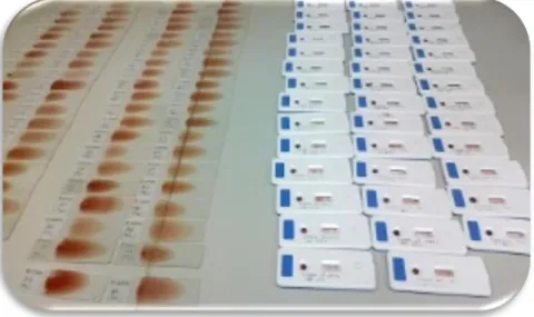Figura 3- Esfregaços sangue e teste rápido Witness®Dirofilaria realizados no processamento  das amostras de sangue (Original)