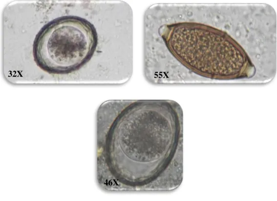 Figura 6- Esquerda: ovo de Toxocara spp.; Direita: ovo de Tric h uris vulpis; Em baixo: Ovo  de Toxascaris leonina (Original)