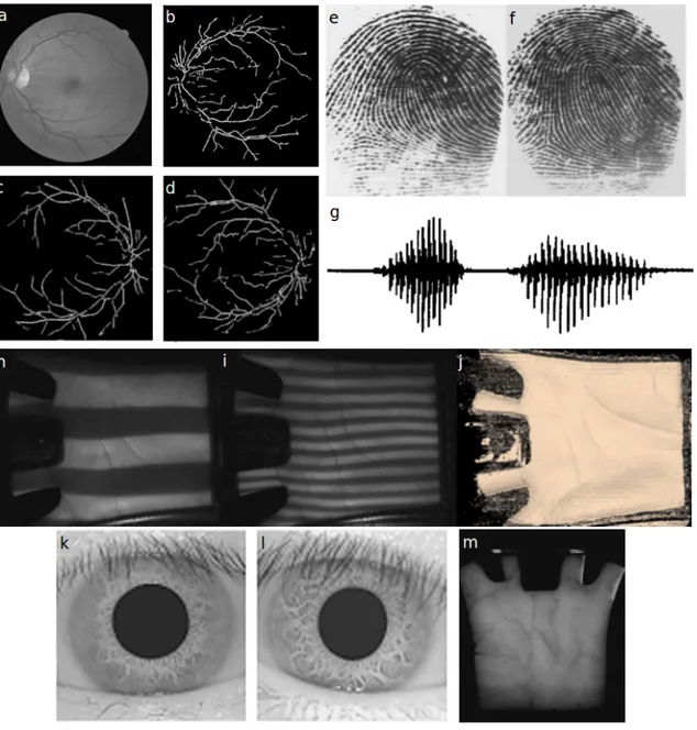 Figure 1.1: Biometric characteristics. a) Retinal fundus image and b) correspondent vascular- vascular-ization