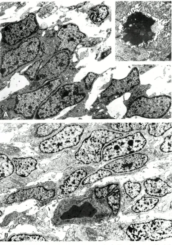 FIG. 8 (A) BSS: Spindle and epithelioid transitional cells. Uranyl acetate and lead ci- ci-trate, x 3,600