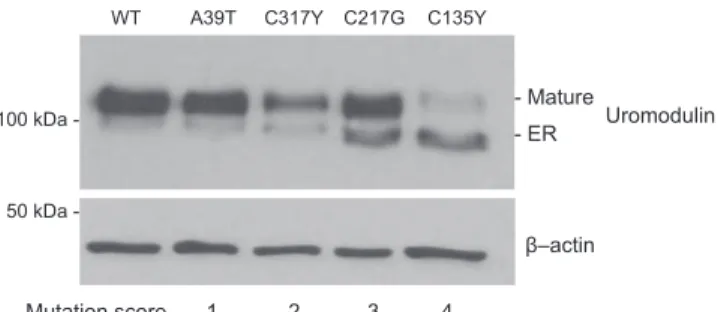 Figure 6. Representative Western blot results from mutant UMOD (mUMOD) in vitro experiments (Supplementary Methods)