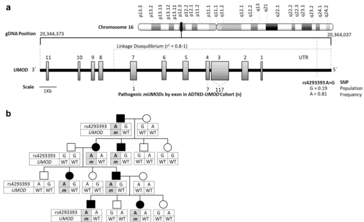 Figure 1. Genetic map of rs4293393 and UMOD with a representative autosomal dominant tubulo-interstitial kidney disease due to UMOD mutations (ADTKD-UMOD) pedigree demonstrating rs4293393-UMOD haplotype inheritance