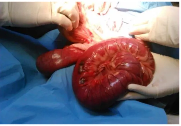 Figura 14 – Cirurgia em canídeo para remoção de corpo estranho intestinal, observando-se  ansas intestinais muito dilatadas e áreas de necrose (fotografia original)