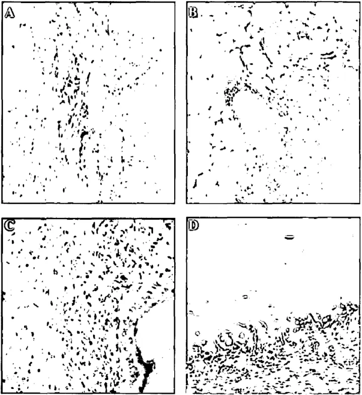 Figura 1 . A) Fotomicrografia da derme de frango de corte, om moderada neovascularização; B) Processo inflamatório misto  acentuado, neovascularização, tecido adiposo e retículo piloso; C) Processo inflamatório misto com presença de  células gigantes; D) D