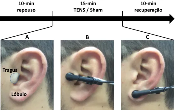 FIGURA  8  –  Protocolo  experimental  do  estudo.  A  área  sombreada  mostra  a  distribuição  do  ramo  auricular  do  nervo  vago  no  ouvido  externo  (A)