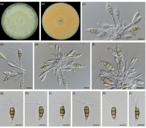 Figure 2. Pestalotiopsis pini (MEAN 1094). (a,b) Colony on PDA after 10 days at 23 ± 2 °C—surface  view and reverse, respectively