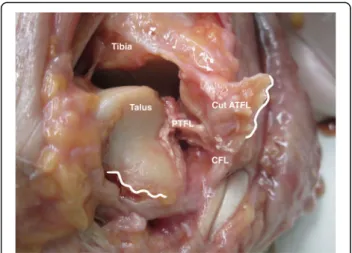 Fig. 1 Image of a cadaveric ankle after cutting the ATFL ligaments.