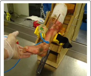 Fig. 4 Ankle in a neutral position for system calibration