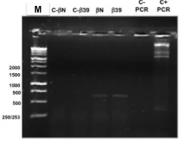 Fig.   10   :   PCR   de   cDNA   de   βN   e   β39.   Gel   de   agarose   a   1%.      