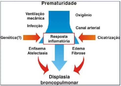 Figura 2.1 - Patogênese da Displasia Broncopulmonar  Fonte: Monte et al., 2005.  