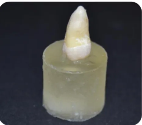 Figure 3: Tooth fixed to an acrylic holder with sticky wax. 