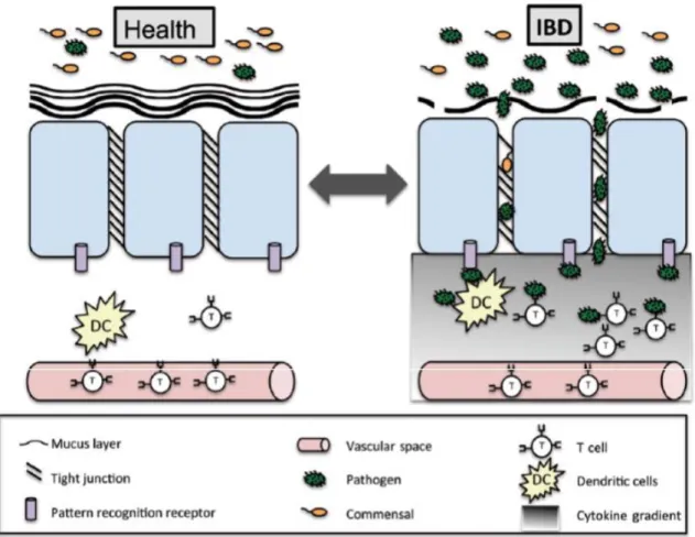 Figura  2  Os  mecanismos  patofisiológicos  da  IBD.  A  barreira  mucosa  de  um  individuo  saudável mantem o conteúdo do lúmen separado do sistema imune