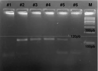 Figura  6:  Gel  de  agarose  2%  resultante  da  eletroforese  da  PCR  para  Leishmania spp