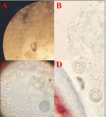 Figura 8. A)  ; B) Apiosoma sp.; C) I. Multifillis; D) Trichodina sp.