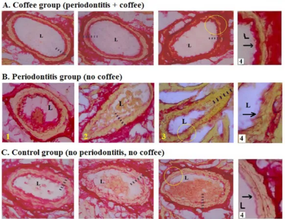 Figure 1: The Histomorphology of the rat’s coronary arteries stained with the Collagen Staining Kit (Picro Sirius Red)