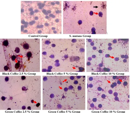 FIGURE 5 - Monocytes that express TNF–α are brown (red arrow), monocytes lysis (black arrow)