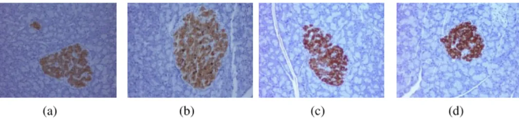 Fig.  1 .  Histological sample images of  (a-b) Normal (c-d) Pre-diabetic pancreas cell
