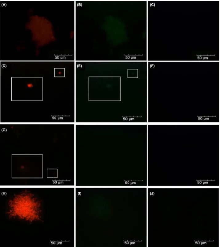 Fig. 1. Microphotographs captured under the epiﬂuorescence microscope in objective ampliﬁcation of 409 of white (A, B, C) and red (D, E, F) grape must, red wine (G, H, I) and Z
