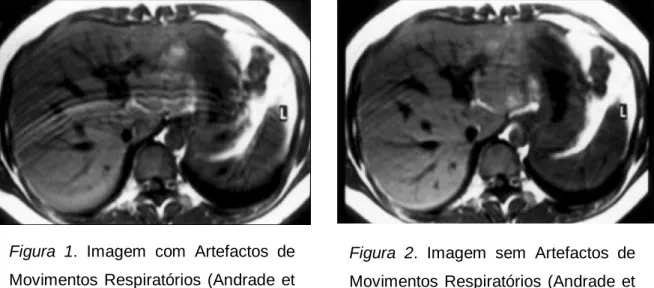 Figura  1.  Imagem  com  Artefactos  de  Movimentos  Respiratórios  (Andrade  et  al., 2002)