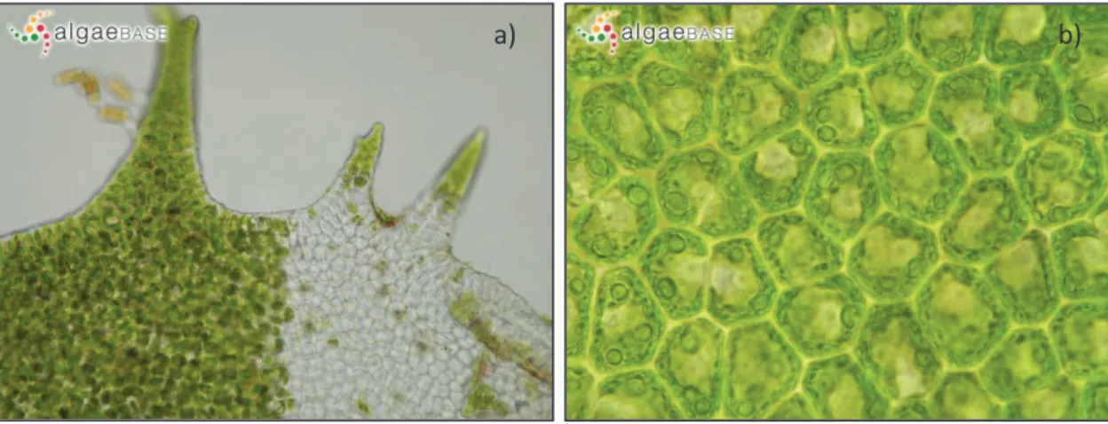 Figura 3. Detalhes de frondes de Ulva rigida: a) espinhos marginais; b) células de superfície com  múltiplos pirenoides (fotos de Ignacio Bárbara, algaeBase 2013)
