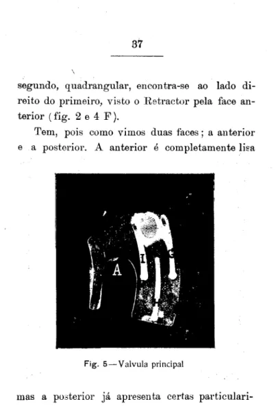Fig. 5 — Válvula principal 