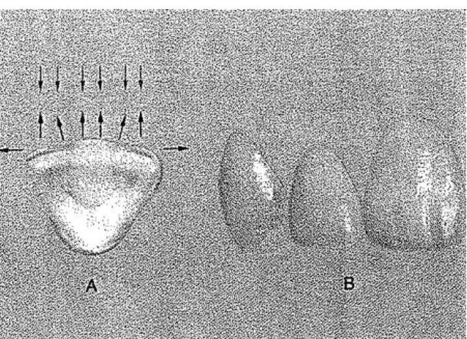 Figura 9 - Morfologia normal do incisivo central - corte vestibulolingual: A - há uma  proeminência central que permite que seja reflectida uma maior quantidade de luz em relação 