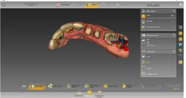 Figura 3 - Software in-lab CEREC: facultada pelo Dr. Paulo Rocha Almeida 