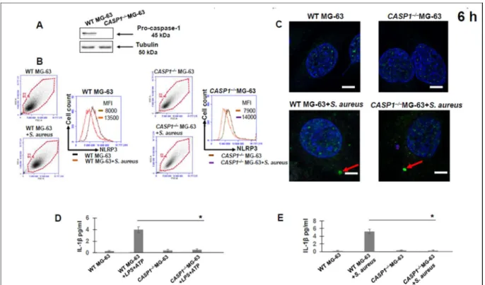 Figure 20: NLRP3 protein expression, speck-like aggregate formation and IL-1β secretion by WT  MG-63 vs CASP1 –/–  MG-63 cells exposed to S