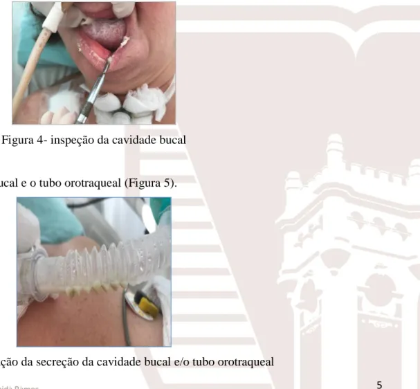 Figura 4- inspeção da cavidade bucal 
