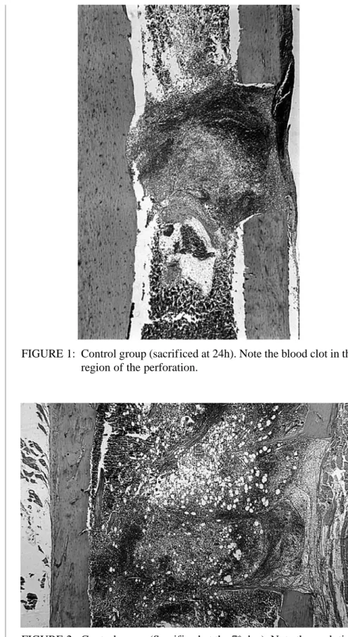 FIGURE 2: Control group (Sacrificed at the 7 th day). Note the evolution of the healing  process with bone neoformation.