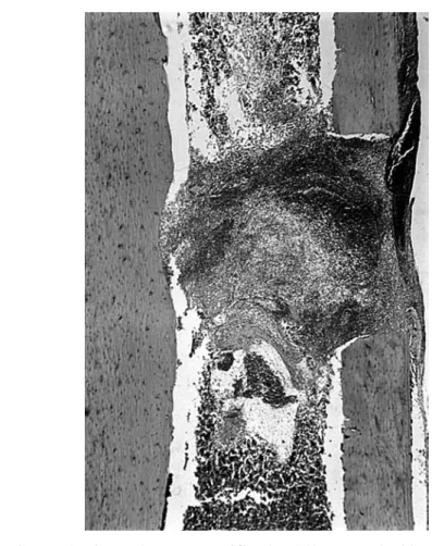 FIGURE 1: Control group (sacrificed at 24h). Note the blood clot in the region of the perforation.