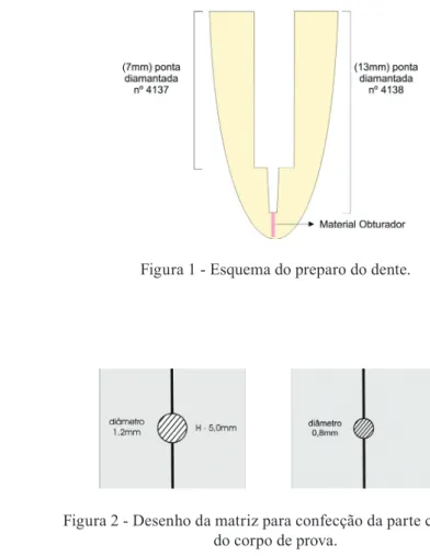 Figura 1 - Esquema do preparo do dente.